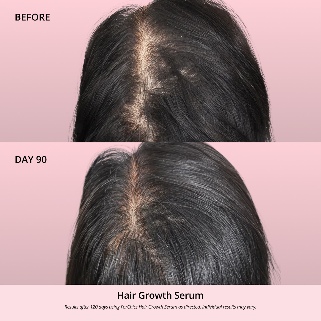 Hair Growth Oil Spray