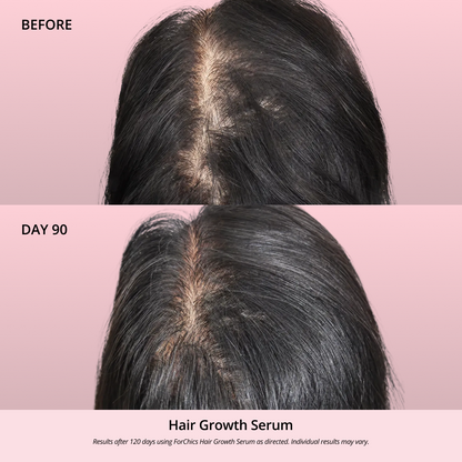 Hair Growth Oil Spray