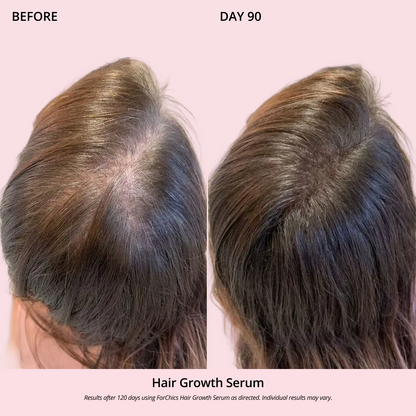 Hair Growth Oil Spray